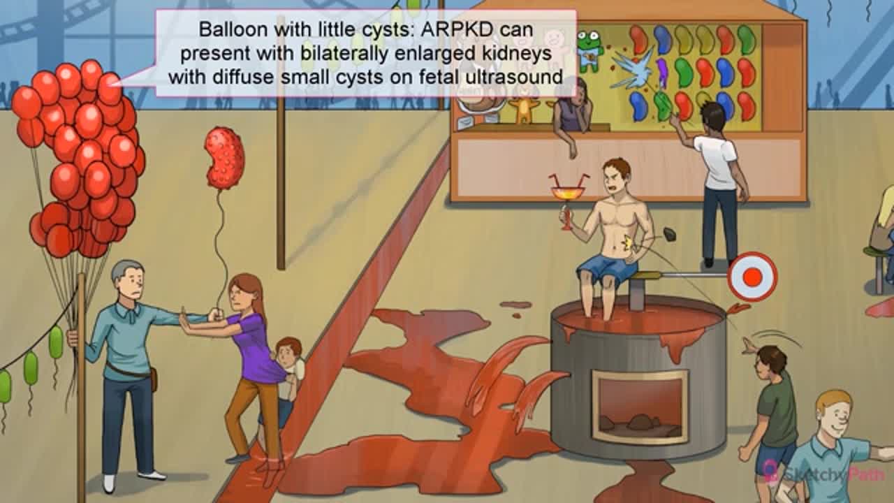 Renal Pathology (sketchy). 3. Congenital & Chronic Kidney Disease