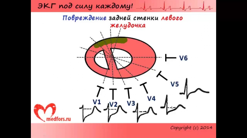 Школа ЭКГ