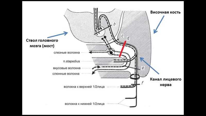 Нейростоматология