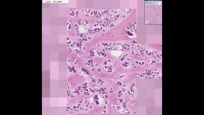 Histopathology