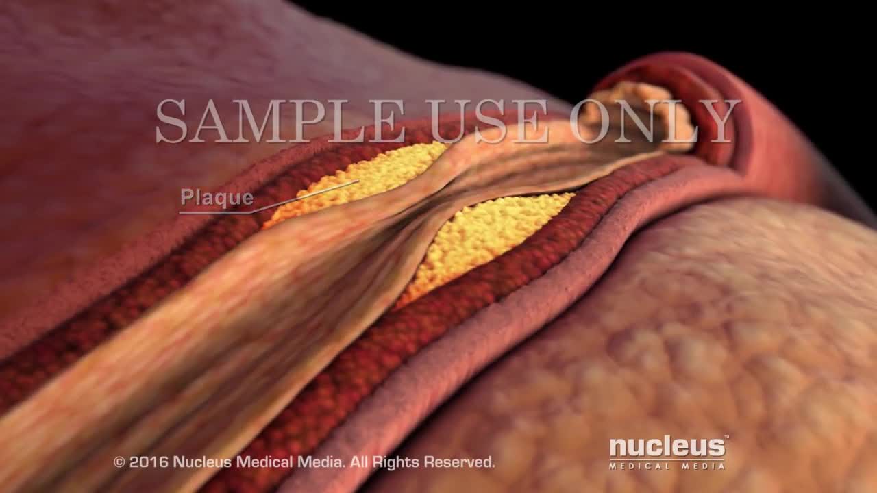 Nucleus Medical Media