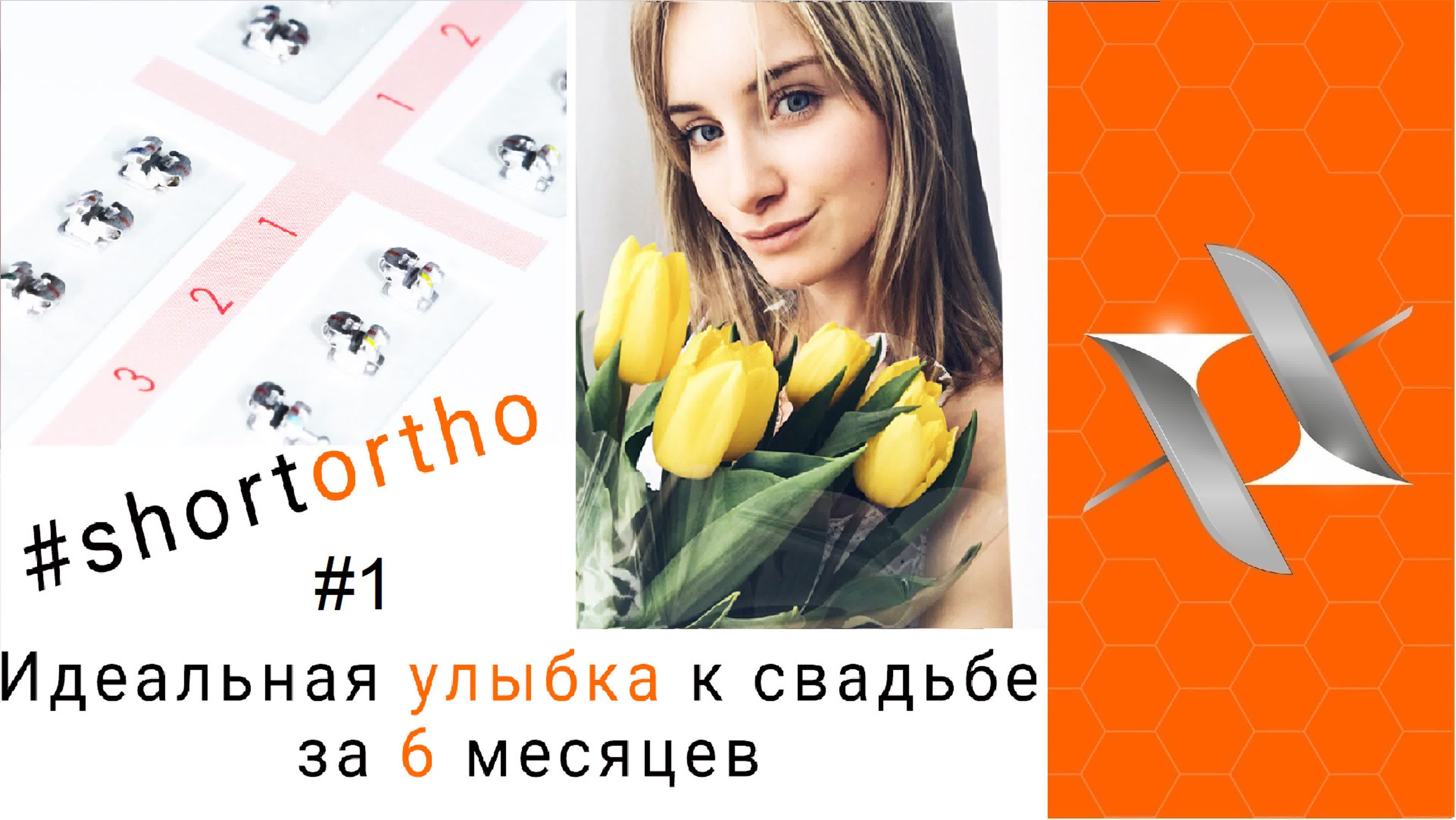 #shortortho Улыбка к свадьбе за 6 месяцев