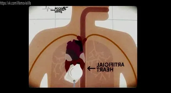 Адреналин: Высокое напряжение (2009)