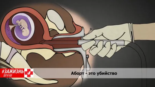 Потапова Татьяна Васильевна, Врач-педиатр, п.Ильский, Краснодарский край. аборт