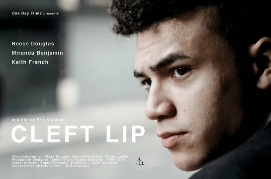 Заячья Губа _ Cleft Lip (2018) Великобритания