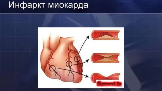 ЭТИ 10 ПРИЧИН ЗАСТАВЯТ ВАС ХОДИТЬ ПЕШКОМ КАЖДЫЙ ДЕНЬ