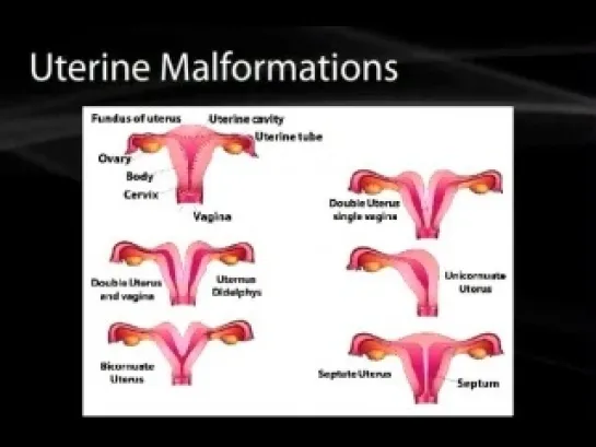 35 Development of the Genetalia