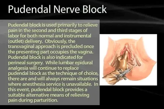 32 Pelvic Nerves and Vessels