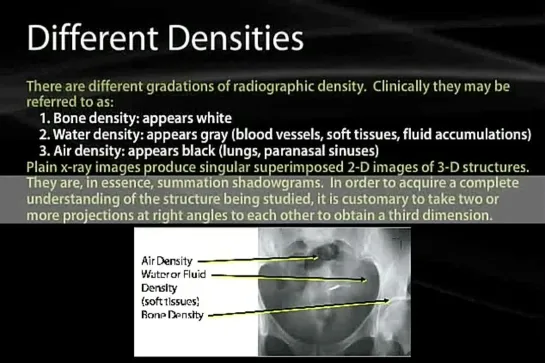 18 Imaging Basics