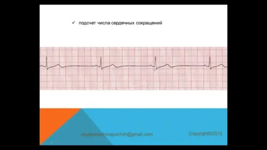 Урок 1 Как определить ЧСС и электрическую ось сердца