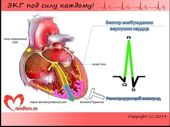 Урок 2. Видеокурс 'ЭКГ под силу каждому'.