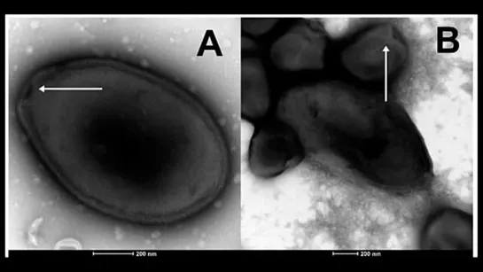 Извлеченный из вечной мерзлоты вирус оказался активным