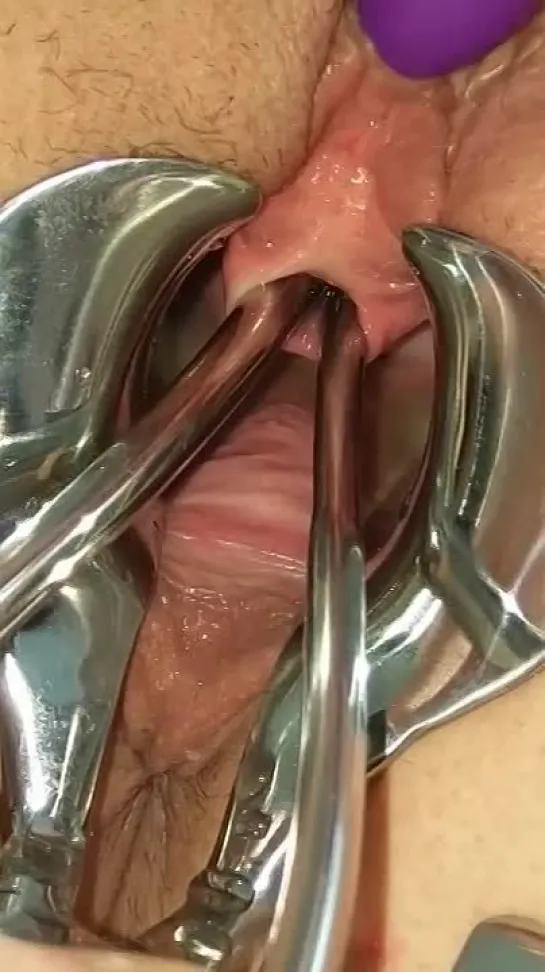 Piss Re-injection - Female Urethral Sounding - BDSM Stretched Wide Peehole