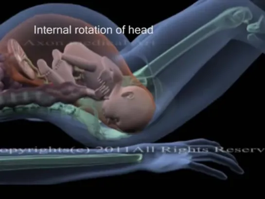 childbirth Animation -movements of fetus during birth