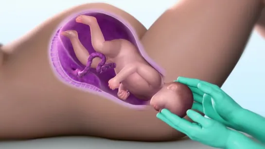 3D Medical Animation - Child Birth Process