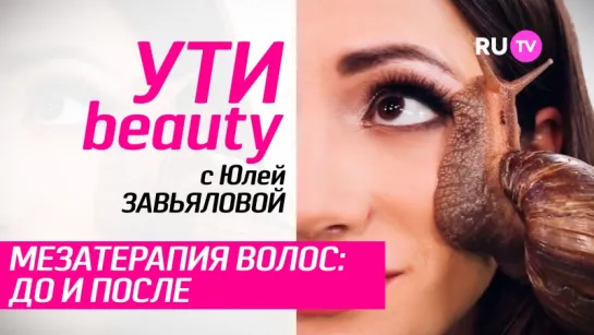 Мезотерапия волос. Здоровые волосы за 2 минуты! | Ути-Beauty. Выпуск 18