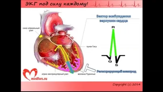 Школа ЭКГ - 2 урок.