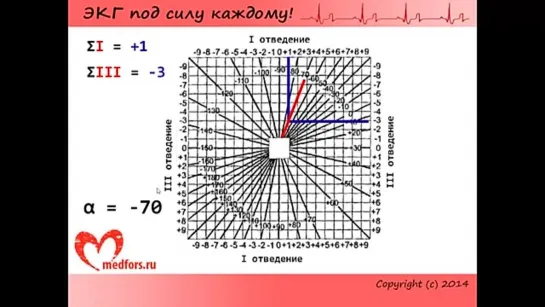 Школа ЭКГ - 3