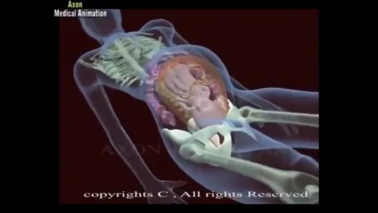 Child birth ! Normal delivery Vs Caesarean delivery, 8 reasons animation