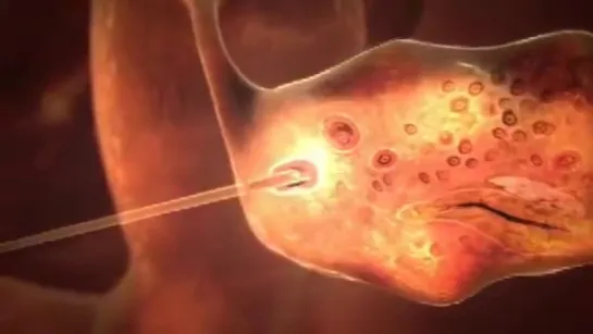 3D animation of how IVF works