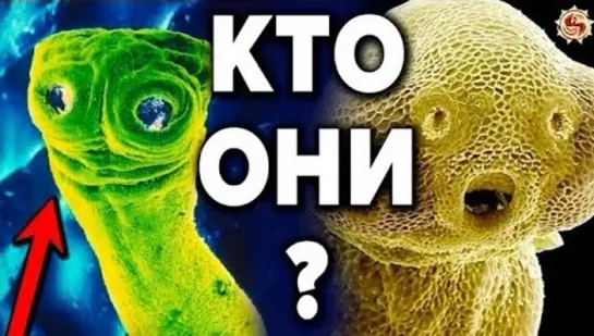 ОНИ ВНУТРИ НАС ? ПАРАЗИТЫ - ГЛАВНОЕ ЧТО НУЖНО ЗНАТЬ О НИХ И КАК ОТ НИХ ИЗБАВИТЬСЯ