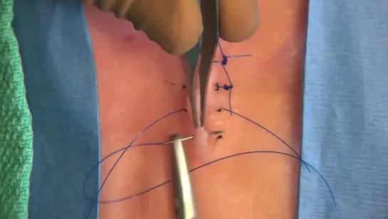 Швы. 3 Interrupted Sutures- Simple, Vertical Mattress,  Horizontal Mattress.mov