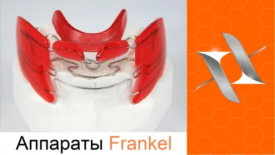 Ортодонтический аппарат Френкеля 1 - 4. Orthodontic appliance Frankel 1-4