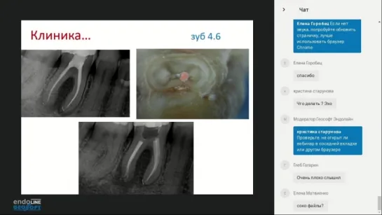 Endo.Education Вебинар Евгения Платонова "Инновации в обработке корневых каналов с последующей обтурацией гуттаперчей"