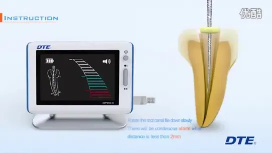 Апекслокатор Dpex III Woodpecker. Стоматология.