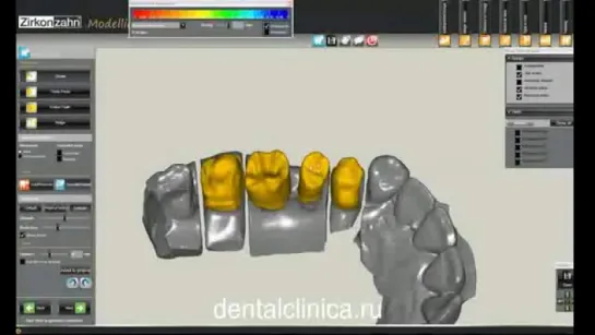 Клиника эстетической стоматологии, моделирование CAD CAM, имплантация протезирование