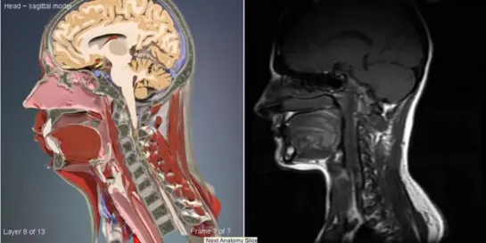 КТ сагиттальный разрез головного мозга и головы. Анатомия.