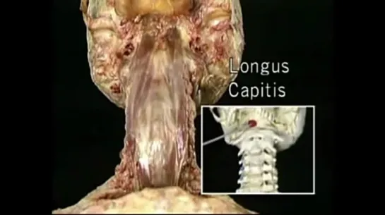 Анатомия головы и шеи. Фильм 4 целиком.   Русский перевод из атласа Экланда