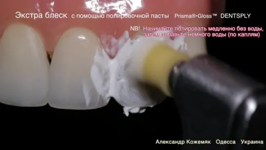 Финишная полировка DENTSPLY (rus). Стоматология.