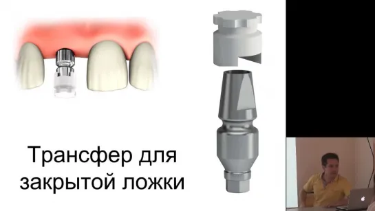 Основы протезирования на дентальных имплантатах