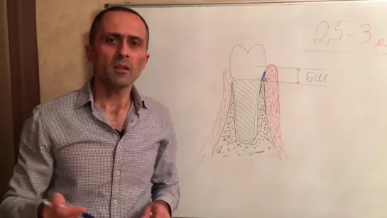 Биологическая ширина. Важный нюанс протезирования зубов. Артак Антанян.