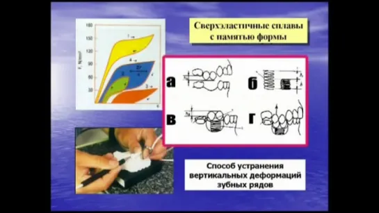 Проблемное зубочелюстное протезирование и роль ортодонта в решении проблемы.