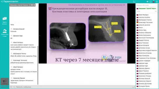 Вебинар "Периимплантит". Ивашкевич С.Г.