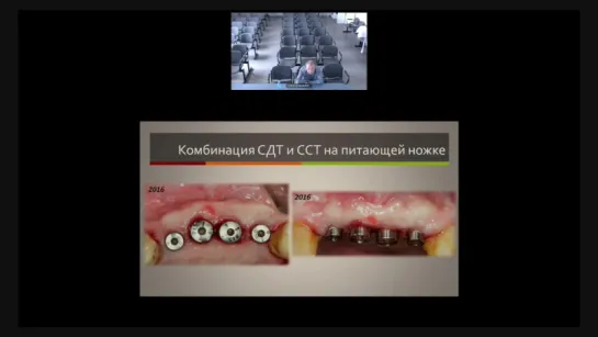 Коррекция мягких тканей лицевой области в практике стоматолога