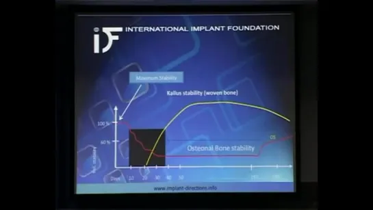 Кортикальная остеоинтеграция ч. 5. Имплантация.