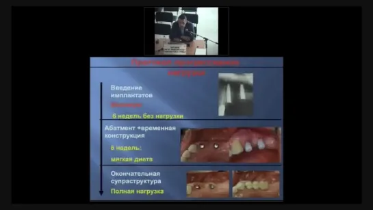 Дентальная имплантация- вчера, сегодня, завтра