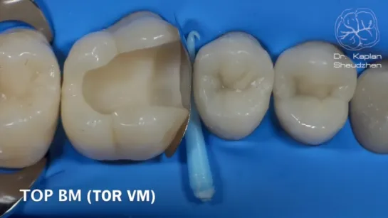 DentalПлюшки 11- адаптация матрицы