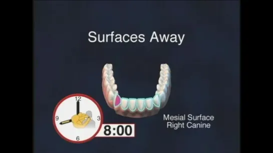 Dental Hygiene - Clock Positions