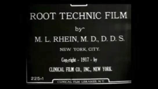 Старейшее видео про методику лечения корневых каналов зуба, записанное в 1917 доктором M. L. Rhein, MD, DDS.