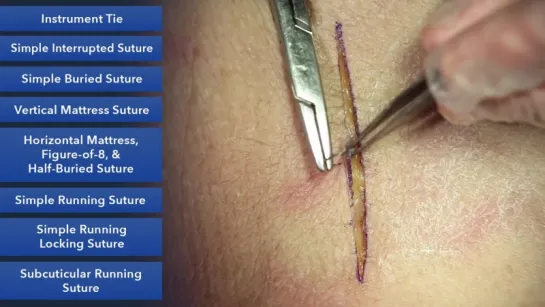 Duke Suture Skills Course - Learn Best Suture Techniques