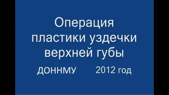 Операция пластики уздечки верхней губы (френулопластика) при диастеме. Детская стоматология.