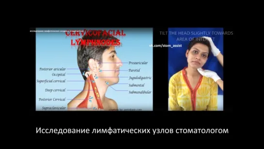 Анатомия и исследование лимфатических узлов в стоматологии.