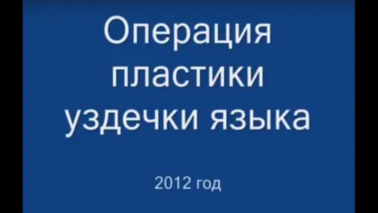 Операция пластики короткой уздечки языка