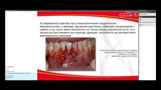 Инновационные коллагеновые биоматериалы, применяемые в стоматологии. Вебинар Ю.Л. Васильев.