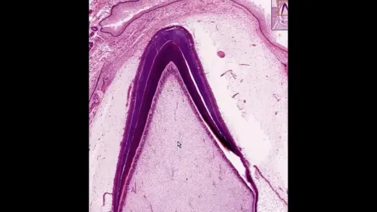 Развитие зуба. Стадия образования тканей зуба. Гистология.