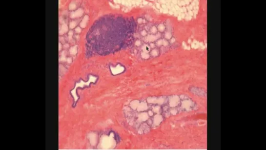 НЕБНАЯ МИНДАЛИНА. PALATINE TONSIL. В световой микроскоп. Гистология.